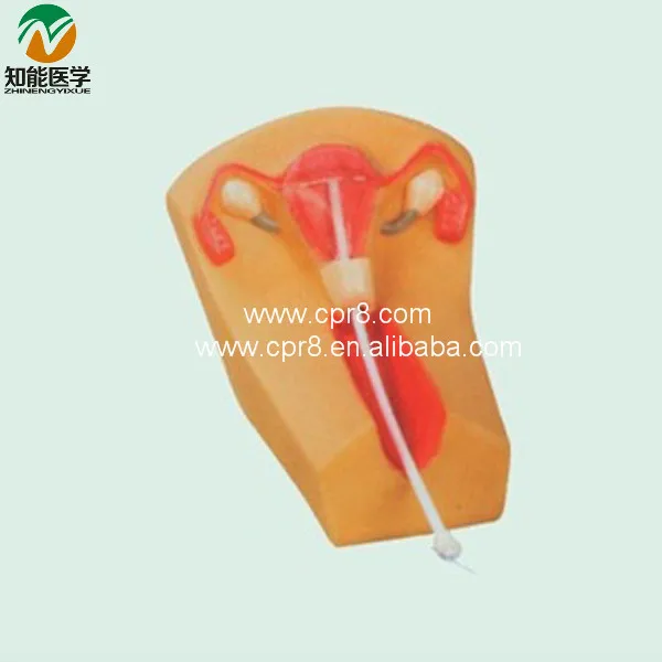BIX-F5N medical science Female Intrauterine Contraceptive Training Model for Disease Demonstration Medical Teaching Tool