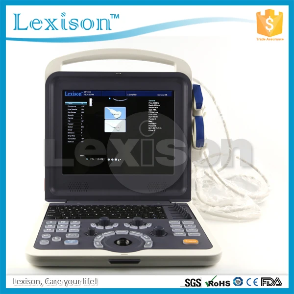 
Cardiac Portable Ultrasound 4D Ultrasound Scanner Color Doppler Ultrasound Machine Price 