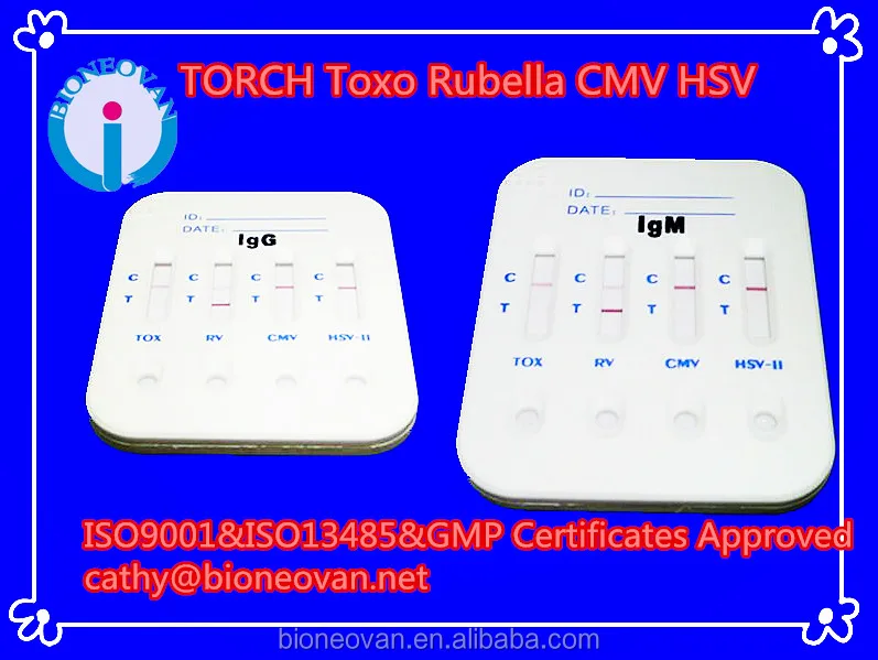 Горелка для обнаружения больницы (4 в 1) CMV /Rubella/токсиплазма/реагент быстрого теста на герпес