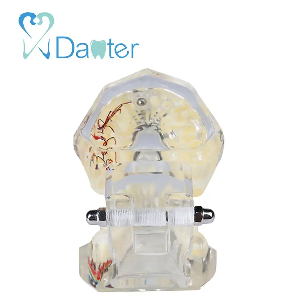 A200-2 All in one Dental Implant Model with Nerve and Removable Teeth crown bridges