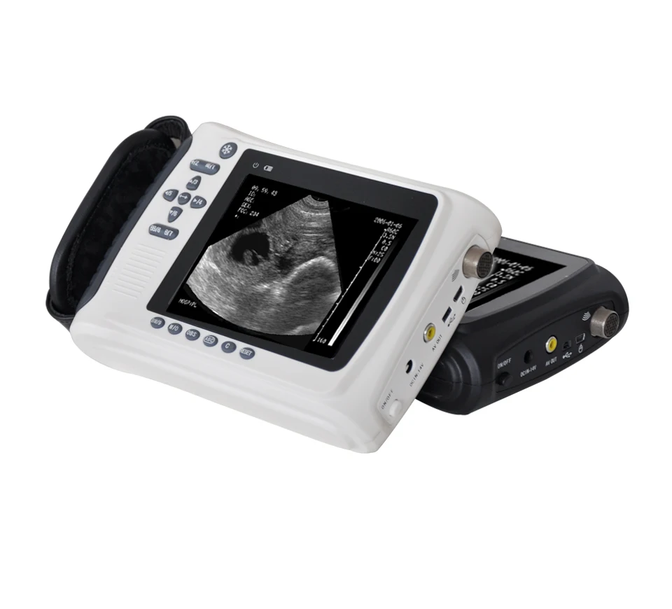 Portable Veterinary Ultrasound Equipment Cow /Horse /Goat /Pig Pregnancy Ultrasound Scanner Echograph Machine
