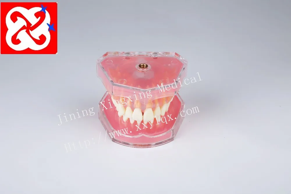 Extractable teeth model demonstrate tooth structure anatomy practice model with soft silicone gum adult