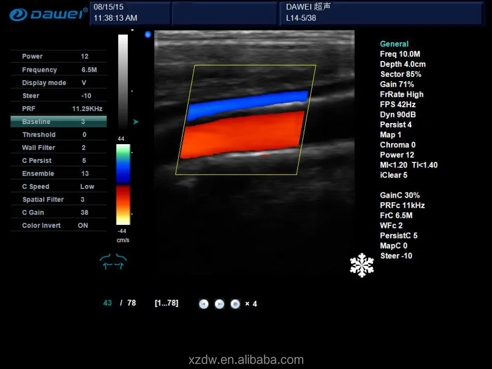 Portable echography machine/ laptop ultrasound scanner/portable echo machine color doppler