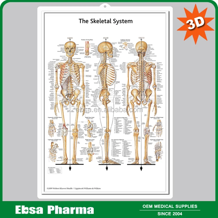 Educational Plastic 3D Medical Anatomical Wall Chart - Understanding Arthritis
