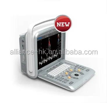Chison Q9 Portable 4D Color Doppler Ultrasound USG 15inch High resolution color LCD