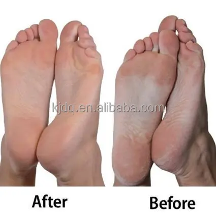 Rollers Refill Heads Extra Coarse Compatible Foot Files Electronic Pedicure