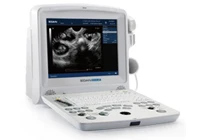 Edan ultrasound machine /ultrasound portable edan dus 60