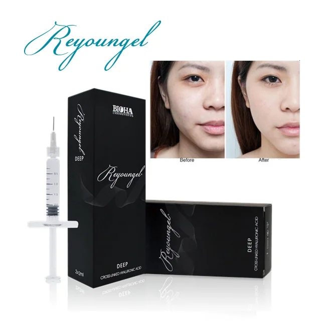 
Reyoungel Cross Linked Hyaluronic Acid Buy Injectable Dermal Fillers 