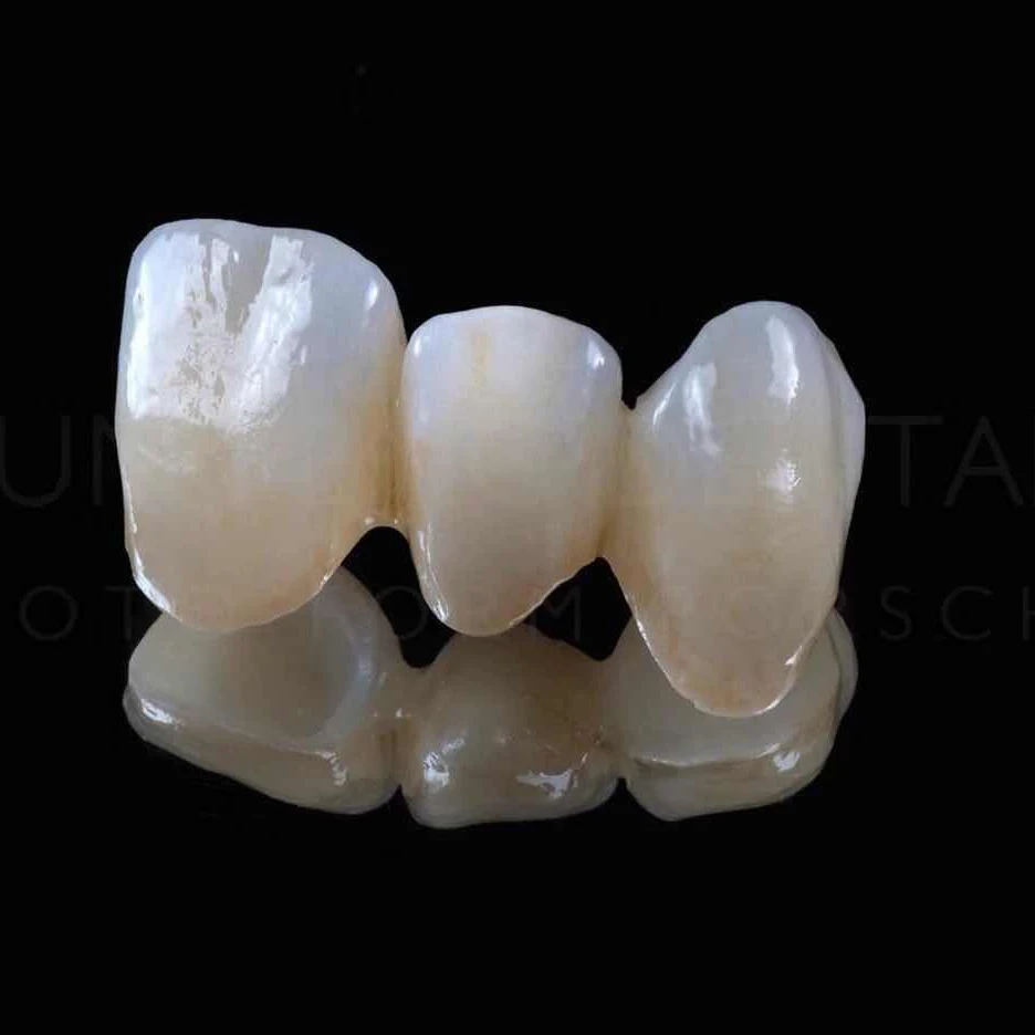 Распродажа стоматологического лабораторного оборудования! Цирконий Корона мост Dental cad cam изготовление зубных протезов 4 оси фрезерный станок с ЧПУ