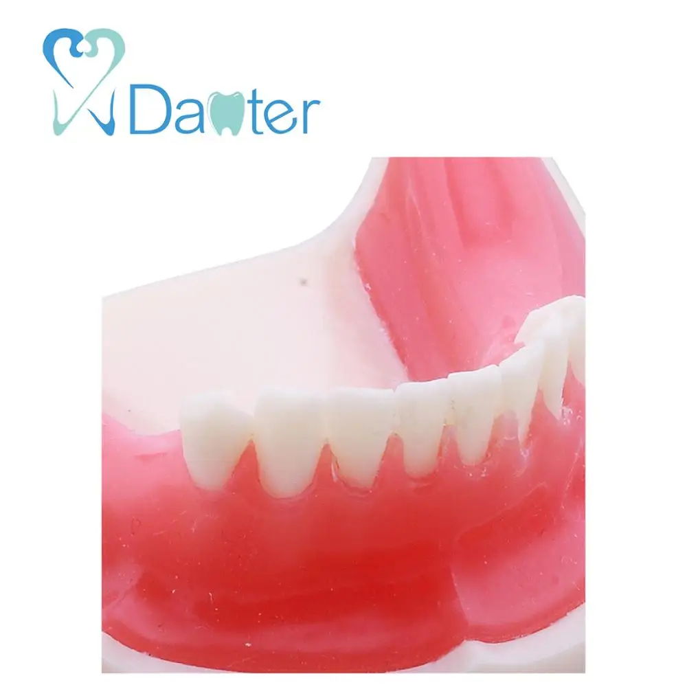 Most Popular Implant Practice Mandibular Jaw Model for Dentist Practice