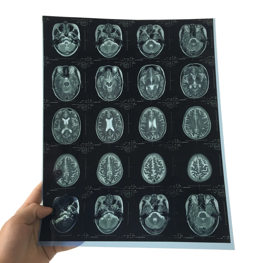 Waterproof Thermal  Printing Blue Sensitive Medical X-ray Film Same as agfa DT2B and DT5B 14x17