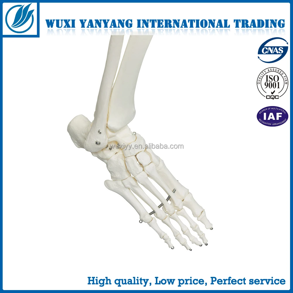 Full Size 170 Cm Human Skeleton with Open Skull, Muscle Painted and Ligament