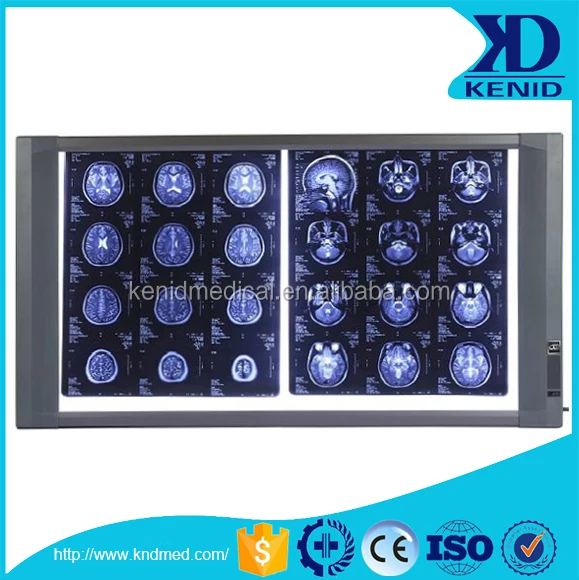 
KENID Top Brand X-ray Medical Film Viewer Xray Film Reader X Ray LED Viewing Box 
