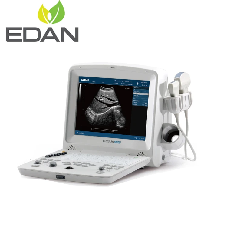Edan ultrasound machine /ultrasound portable edan dus 60