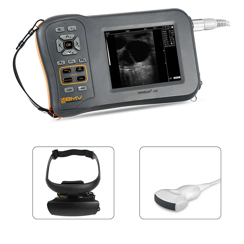 Hot sale portable L60 ultrasound machine china