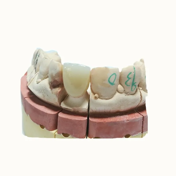 
Good metal and porcelain false teeth 