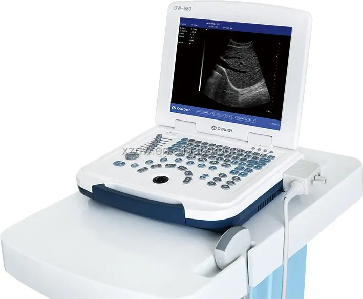 Dawei low price portable ultrasound scan machine for pregnancy DW580