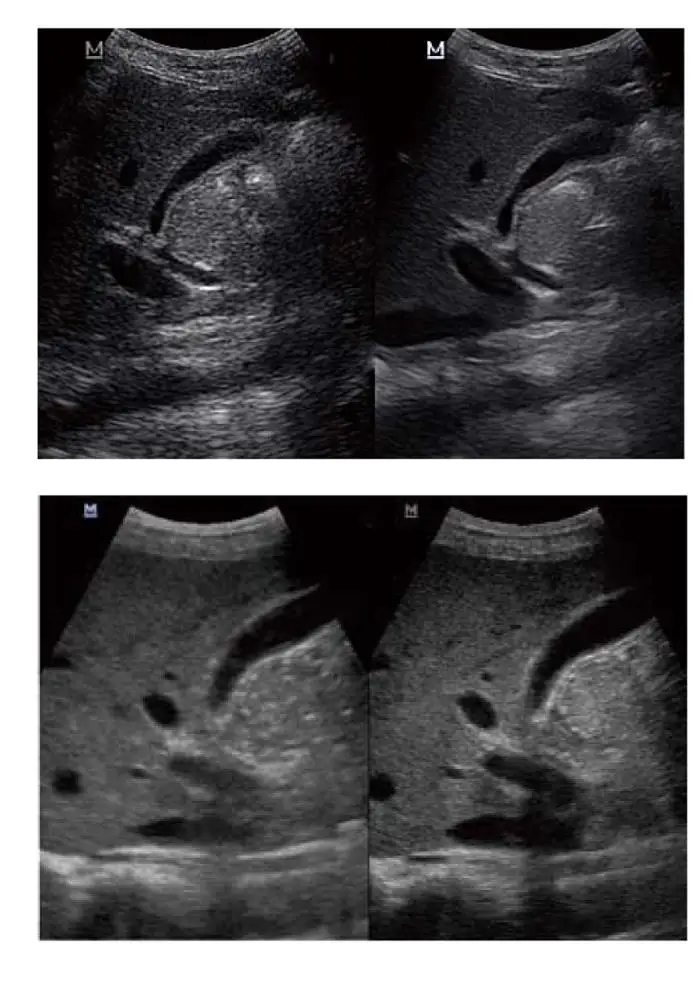 Portable Mindray ultrasound price mindray dp50/mindary ultrasound