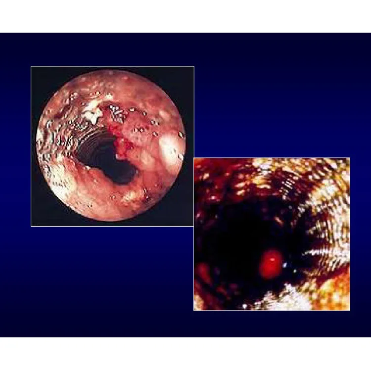 ARGON SYSTEM Electrosurgical operation theater Unit with eleven out mode surgical equipment