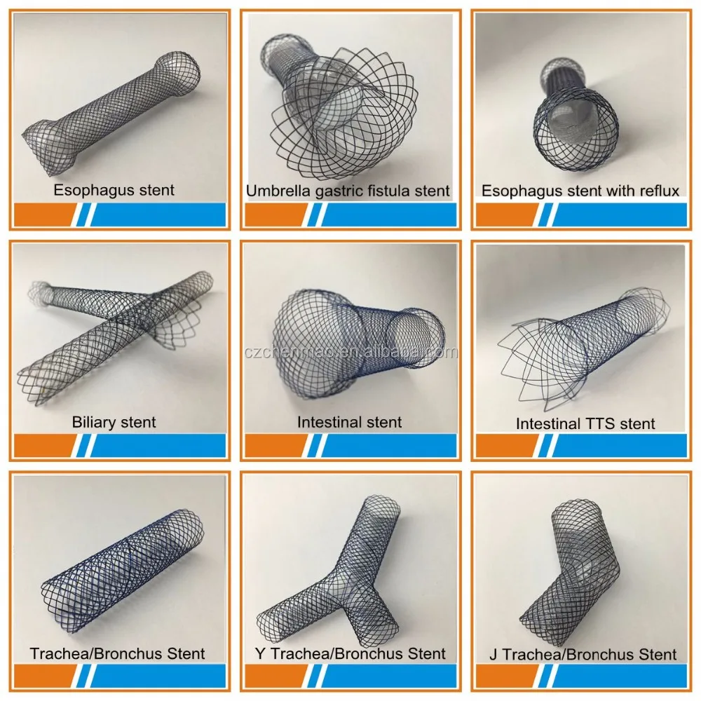 Хирургический саморасширяющийся стент из никель-титанового сплава для пищевода