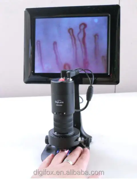 DMX980-2 микроскоп микроциркуляции микрососудистой медицинское оборудование микрососудистой крови