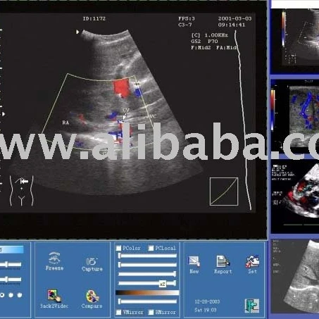 
Software Of Ultrasound Image Manage 