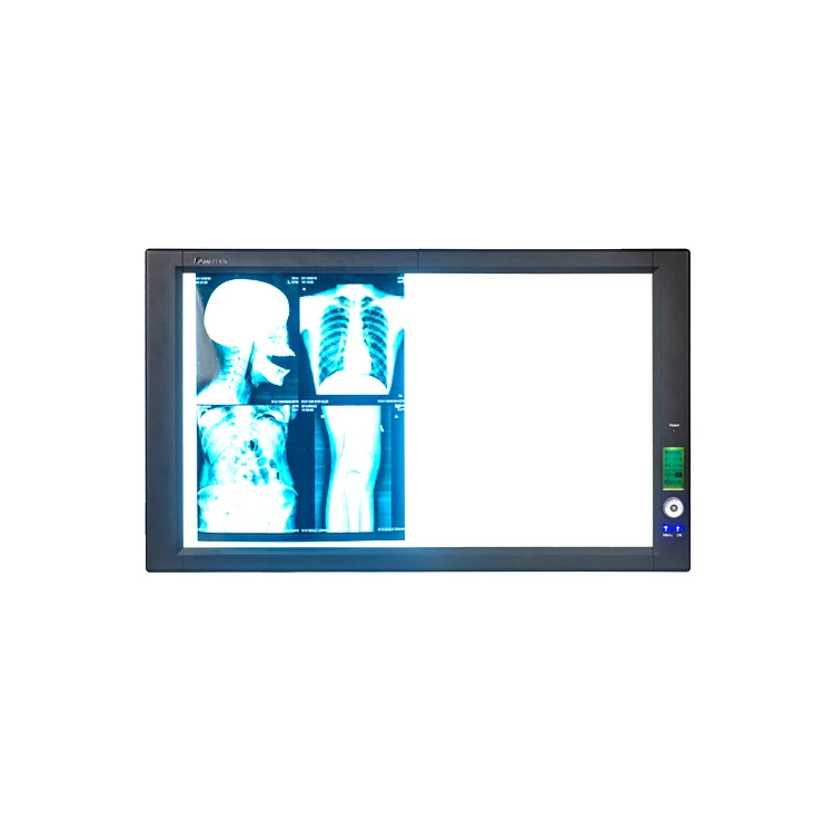 Mplent top sales ZG-2C smart led slim x-ray film viewer negatoscope X Ray illuminator with CE with ISO13485 factory