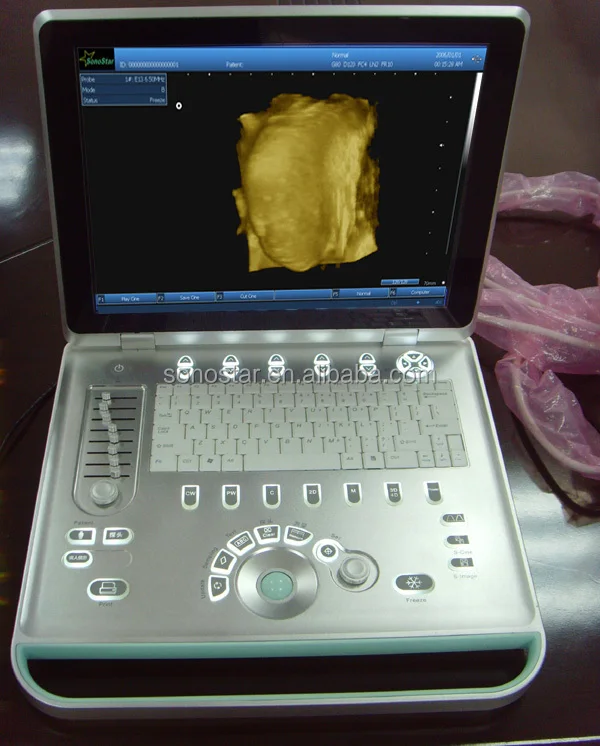 
3D 4D laptop ultrasound machine for pregnancy SS-9 Model 