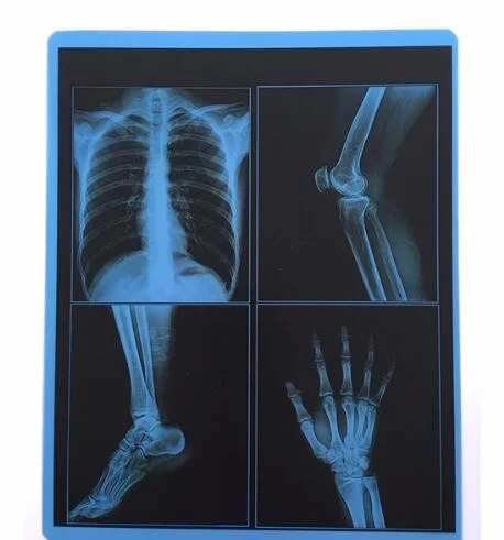 drystar agfa dt2b film hot sexy tube for x ray tube