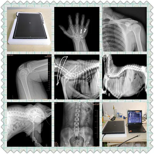 radiology flat panel digital portable x-ray machine