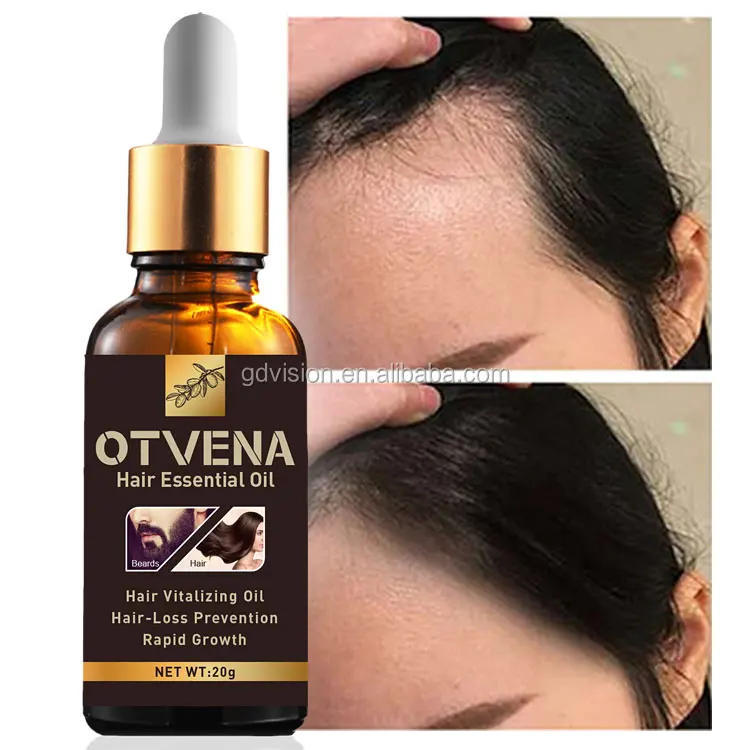 Best For Hair Thinning Loss Treatment Enhance Hair Density Thickness Growth Oil