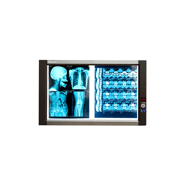 Mplent top sales ZG-2C smart led slim x-ray film viewer negatoscope X Ray illuminator with CE with ISO13485 factory