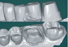 Портативный стоматологический сканер Demetdent SC360T, синий свет, 3D сканер