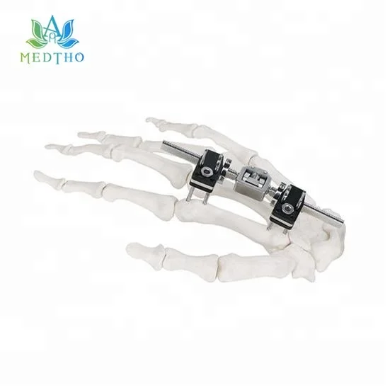 
orthopedic external fixation external fixator Mini Fragment External Fixator for Finger and Palm 