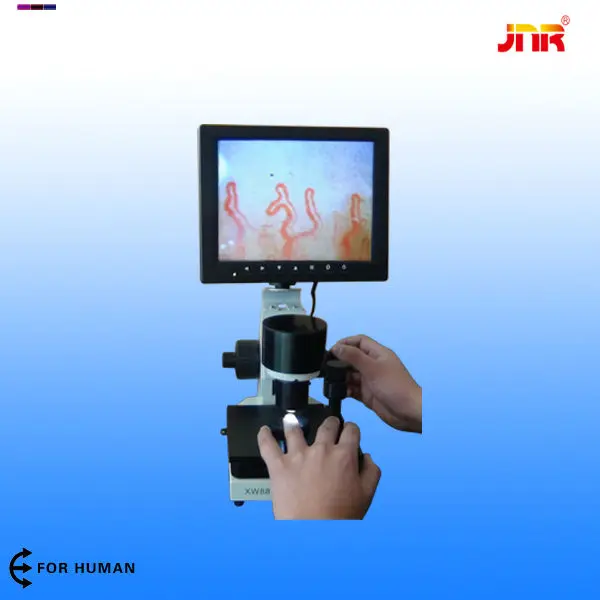 video capillary microcirculation microscope capillaroscopy analyzer