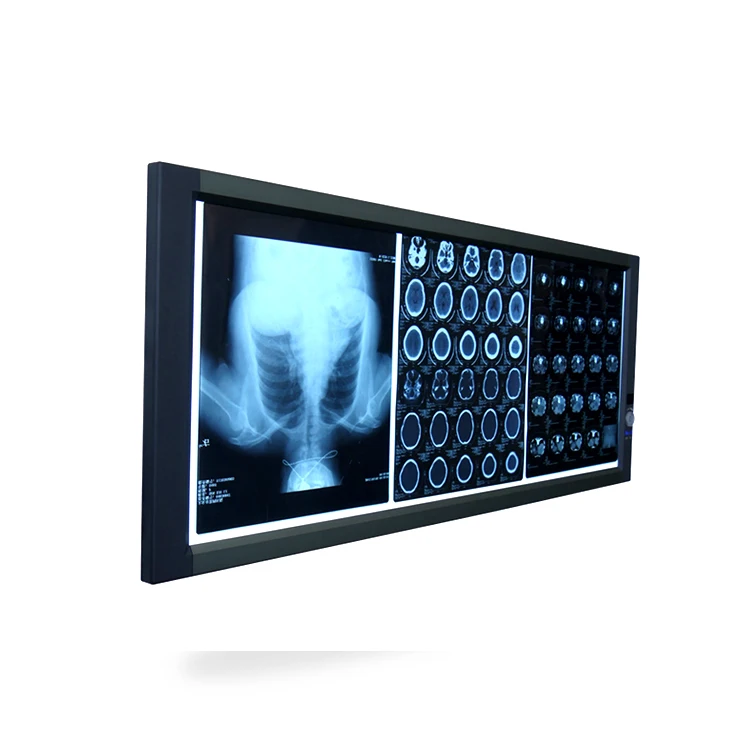 
Best quality Mplent triple bank led xray film viewer box 