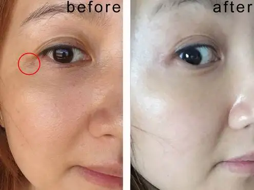 Organic face Cream Face Whitening Cream Best Bleaching Cream For Dark Skin