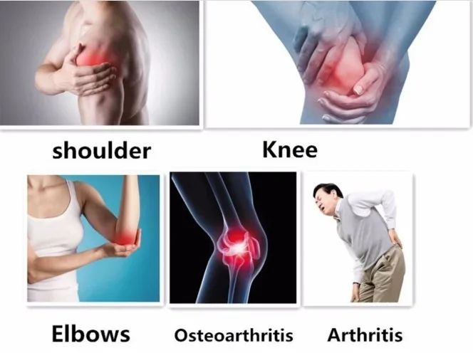 low level Laser acupuncture back pain arthritis  joint pain cold laser 808nm for Wound healing rheumatism gout pain relief