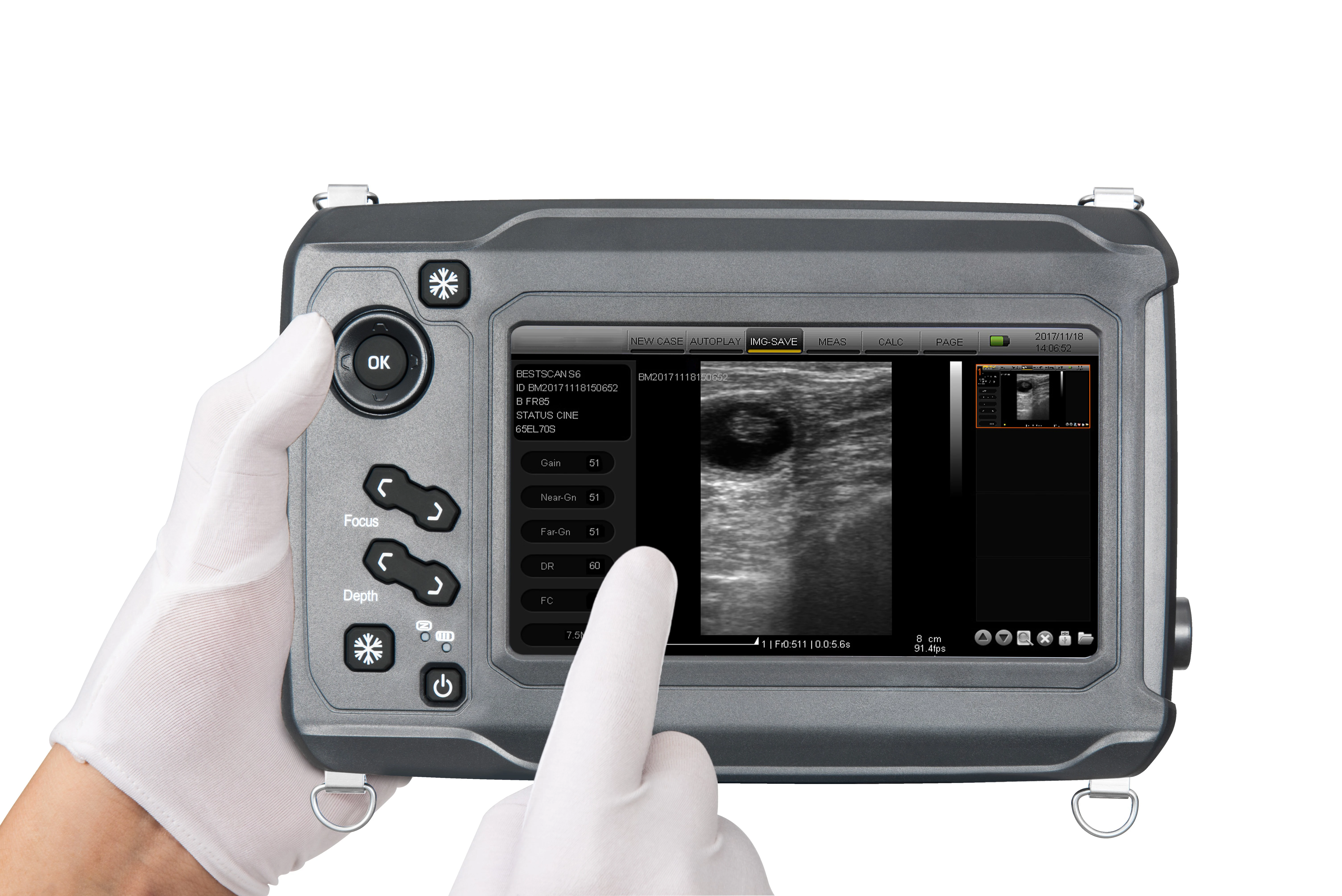 handheld ultrasound device for farm use BestScan S6