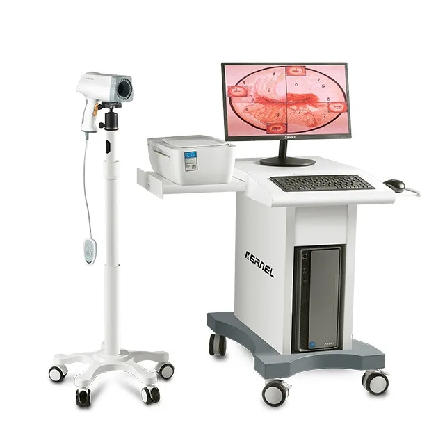 2020 Hot sale colposcope digital camera sony video colposcopy gynecologie for gynecology examination in hospital