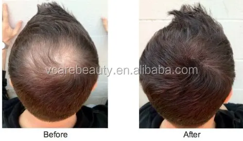 building fibers instant hair loss saver hair fiber free sample hair fibers powder