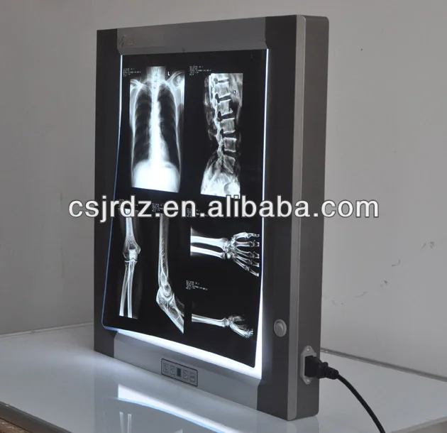 
single bank x ray film reader, backlight LED technology 