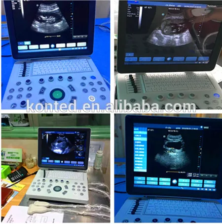 Equine/Cattle/Cow/Horse/Goat//Sheep/Pig/Dog/Cat Portable Veterinary Ultrasound Equipment/Machine/Scanner