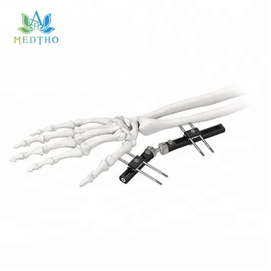 
orthopedic external fixation system external fixator Wrist Joints External Fixator 