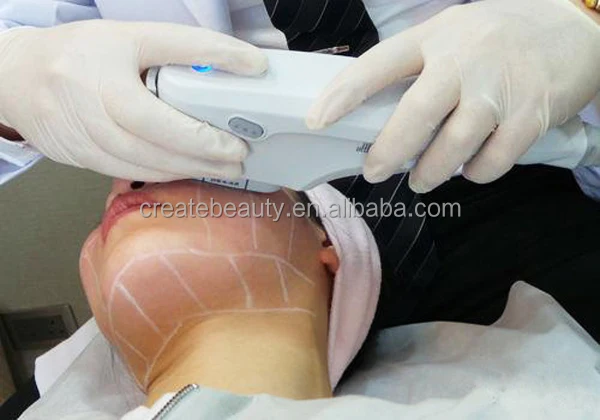 Топ красивая высокой интенсивности сосредоточены Ultrasoundu ультразвуковая липосакция оборудование
