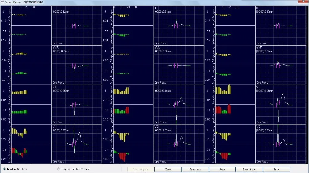 Promotion Product New Digital 3 Channel Holter ECG machine ECG Holter with CE certificate