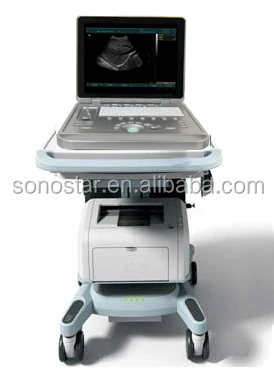 
3D 4D laptop ultrasound machine for pregnancy SS-9 Model 