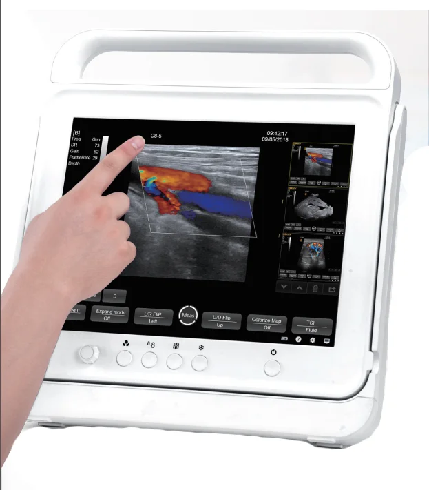 PT50C Human Touch Screen Portable Ultrasound Scanner