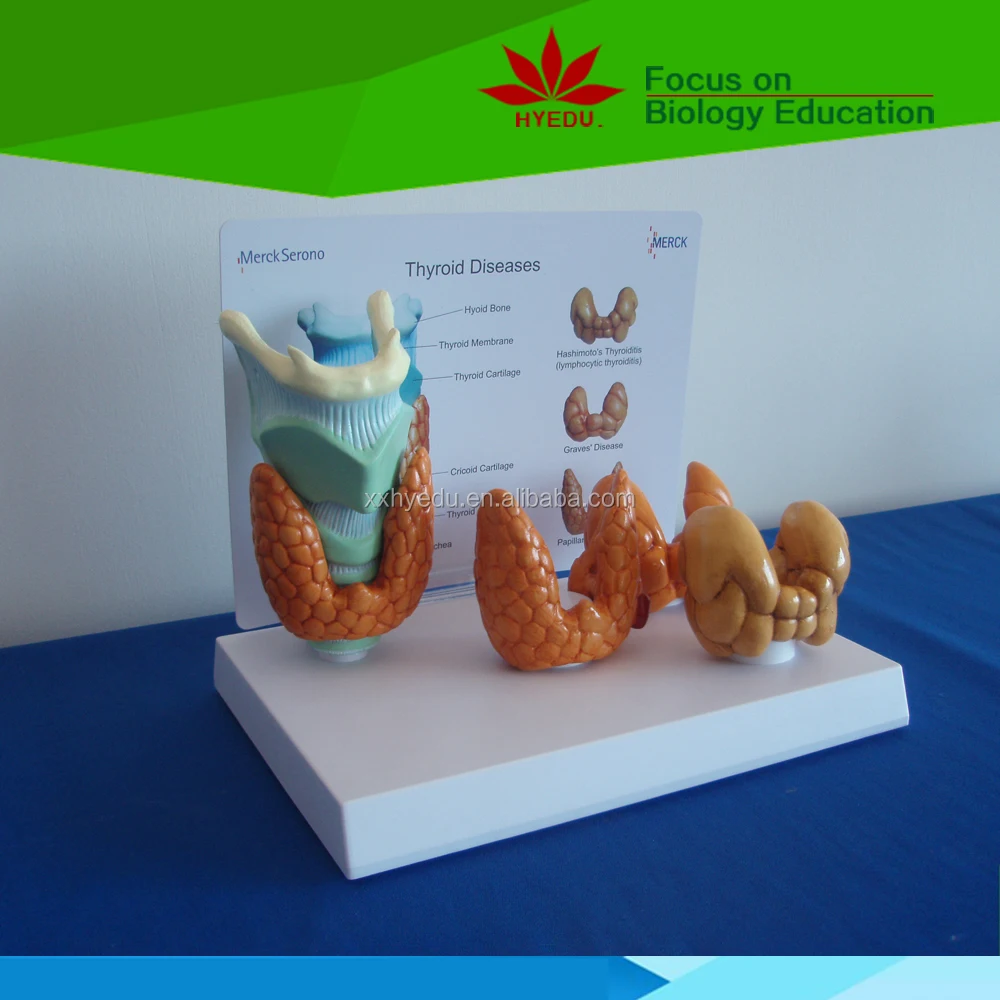 Factory direct sell Thyroid diseases educational model