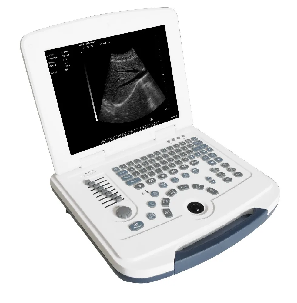 Full-digital B/W Laptop Ultrasound Scanner